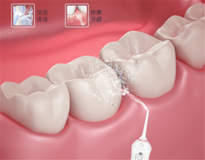 家庭口腔清潔新寵 為何這個(gè)品牌正悄然超越潔碧，成為水牙線首選